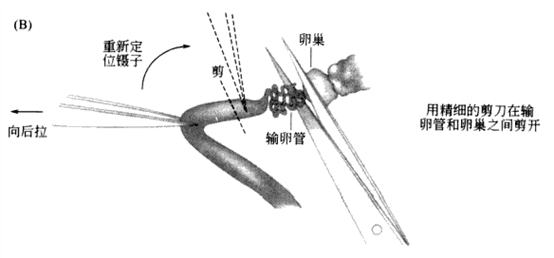 南京爱贝生物的小鼠体外受精操作步骤及操作视频(图7)
