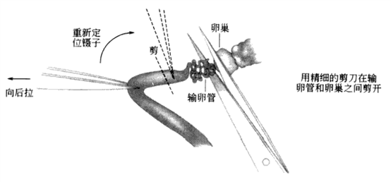南京爱贝生物的小鼠体外受精操作步骤及操作视频(图7) 1-210P509250RH.png